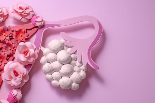 stock photo PCOS 